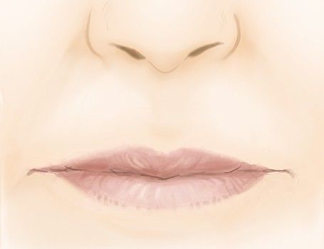 La perte de volume des lèvres par le Dr Marchac à Paris 16