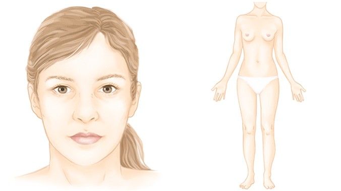 Diagnostic: Les différentes zones